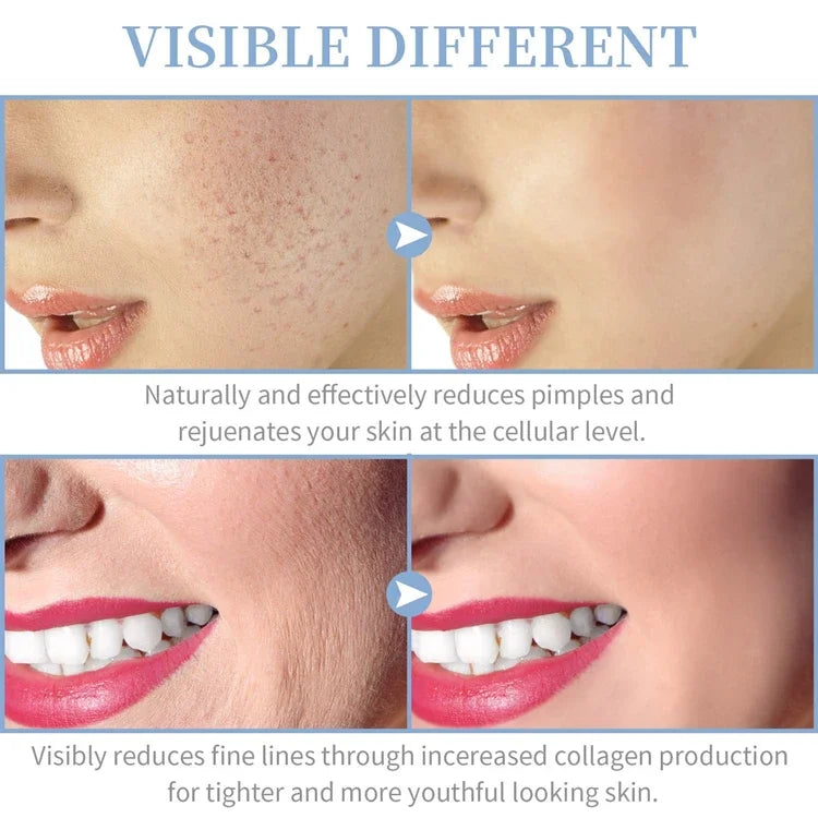 4 en 1 électrique portatif pour le visage outils de beauté de la peau Portable haute fréquence